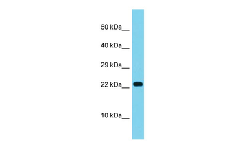 DMAC2L Rabbit Polyclonal Antibody