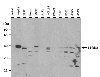 HPF1 Rabbit Polyclonal Antibody