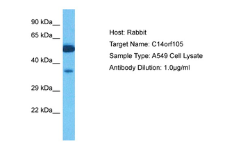 CCDC198 Rabbit Polyclonal Antibody