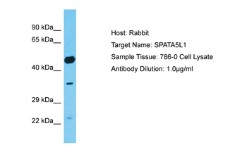 SPATA5L1 Rabbit Polyclonal Antibody
