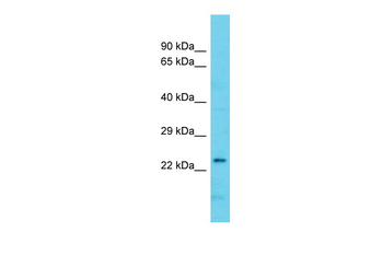 ARMC7 Rabbit Polyclonal Antibody
