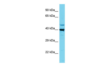 SLC35E1 Rabbit Polyclonal Antibody