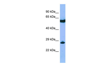C22orf13 Rabbit Polyclonal Antibody