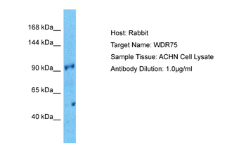 WDR75 Rabbit Polyclonal Antibody