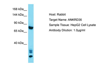 ANKRD36 Rabbit Polyclonal Antibody