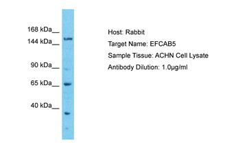 EFCAB5 Rabbit Polyclonal Antibody
