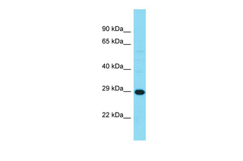 HDHD3 Rabbit Polyclonal Antibody