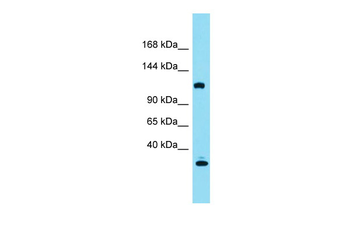 KIAA0355 Rabbit Polyclonal Antibody