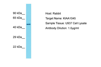 PHF24 Rabbit Polyclonal Antibody
