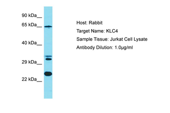 KLC4 Rabbit Polyclonal Antibody