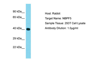 NBPF5 Rabbit Polyclonal Antibody