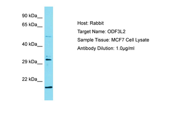 ODF3L2 Rabbit Polyclonal Antibody