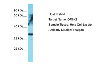 OR6K2 Rabbit Polyclonal Antibody