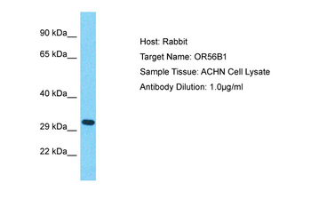 OR56B1 Rabbit Polyclonal Antibody