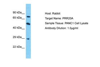 PRR20A Rabbit Polyclonal Antibody