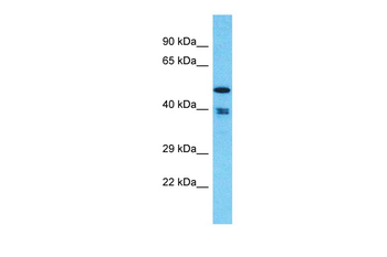 THUMPD1 Rabbit Polyclonal Antibody