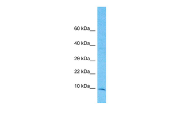 TIMM10 Rabbit Polyclonal Antibody