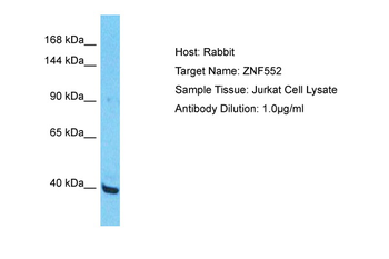 ZNF552 Rabbit Polyclonal Antibody