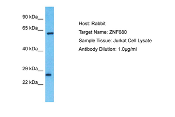 ZNF680 Rabbit Polyclonal Antibody