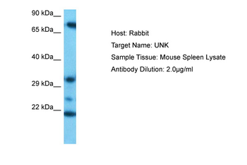 UNK Rabbit Polyclonal Antibody