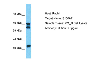 S100A11 Rabbit Polyclonal Antibody