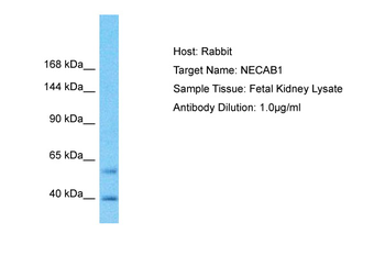 NECAB1 Rabbit Polyclonal Antibody