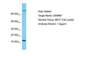 GEMIN7 Rabbit Polyclonal Antibody