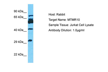 MTMR10 Rabbit Polyclonal Antibody