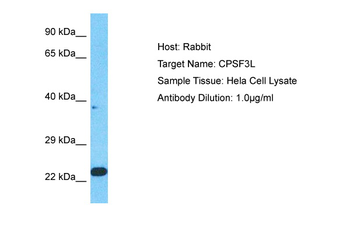 INTS11 Rabbit Polyclonal Antibody