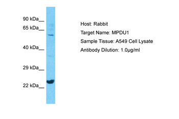 MPDU1 Rabbit Polyclonal Antibody