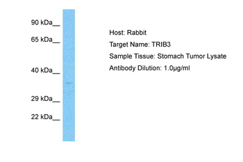 TRIB3 Rabbit Polyclonal Antibody