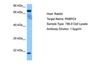 PABPC4 Rabbit Polyclonal Antibody