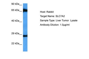 SLC7A2 Rabbit Polyclonal Antibody