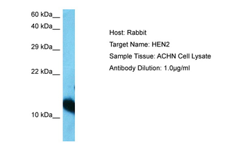 NHLH2 Rabbit Polyclonal Antibody