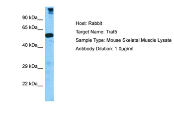 TRAF5 Rabbit Polyclonal Antibody