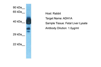 ADH1A Rabbit Polyclonal Antibody