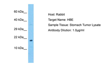 HBE1 Rabbit Polyclonal Antibody