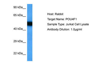 POU4F1 Rabbit Polyclonal Antibody