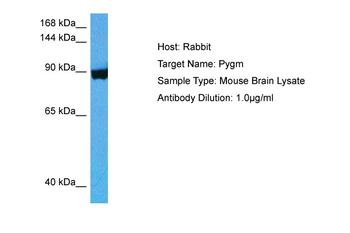 PYGM Rabbit Polyclonal Antibody