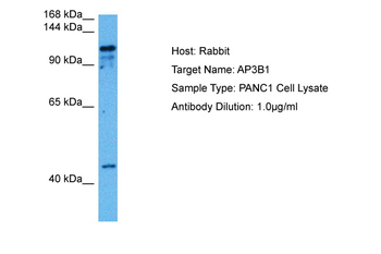 AP3B1 Rabbit Polyclonal Antibody