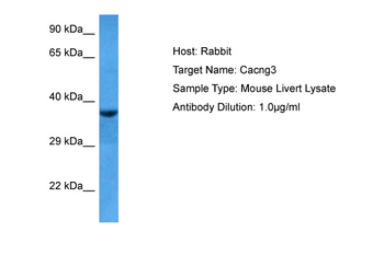 CACNG3 Rabbit Polyclonal Antibody