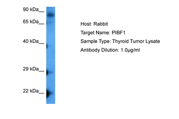 PIBF1 Rabbit Polyclonal Antibody