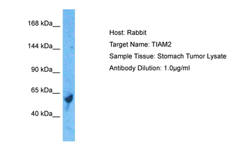 TIAM2 Rabbit Polyclonal Antibody