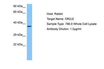 OR2J2 Rabbit Polyclonal Antibody