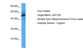 UGT1A5 Rabbit Polyclonal Antibody