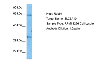 SLC5A10 Rabbit Polyclonal Antibody