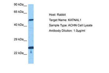 ALDH1A3 Rabbit Polyclonal Antibody