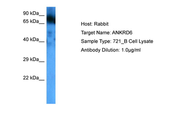 ANKRD6 Rabbit Polyclonal Antibody