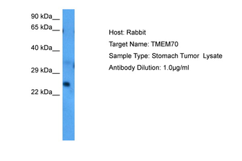 TMEM70 Rabbit Polyclonal Antibody