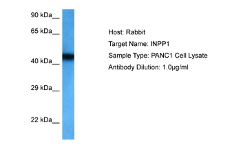 INPP1 Rabbit Polyclonal Antibody